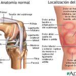 Dolor de rodilla izquierda; Significado espiritual y como tratarlo