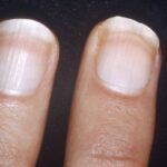Manchas blancas en las uñas: Su significado espiritual y cómo interpretarlas